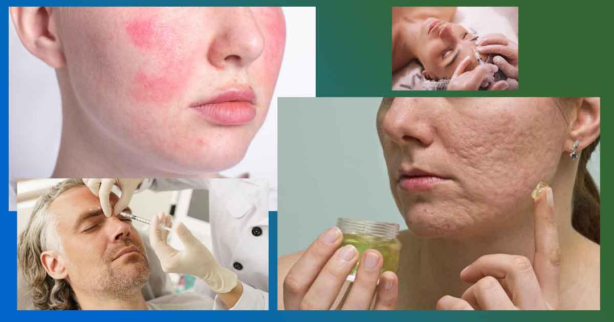 Най-честите странични ефекти от хиалуронова киселина за пиене или при инжекции с нея - в устните, за лице и за стави. Вреди и противопоказания.